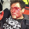 Джеджула обвиняет экс-супругу Санту Димопулос в жестоком избиении (ФОТО+ВИДЕО)